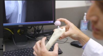 hip joint model