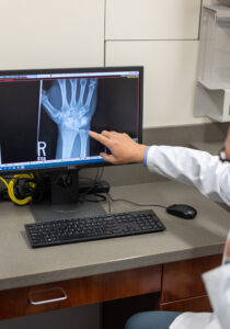 physician reviewing hand xray with a patient
